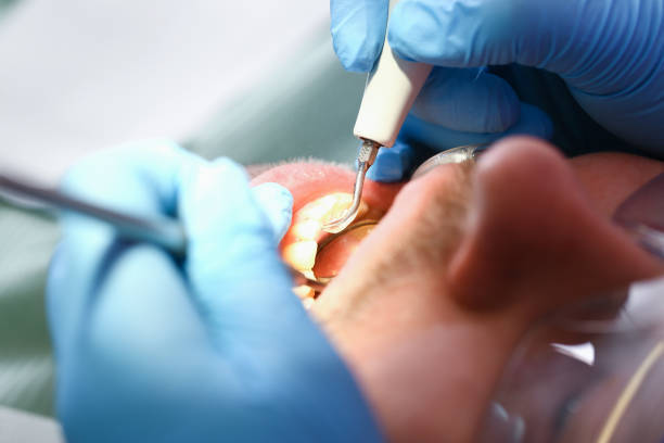 Trusted NJ Emergency Dental Service Experts
